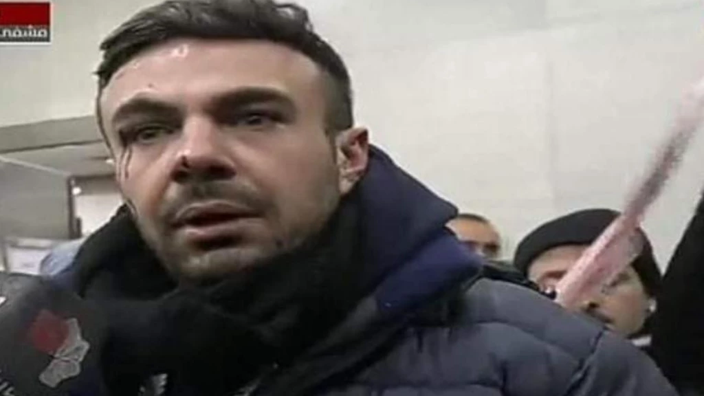 رجل حلبي يهين شادي حلوة ويفضح إعلام الأسد على الهواء (فيديو)