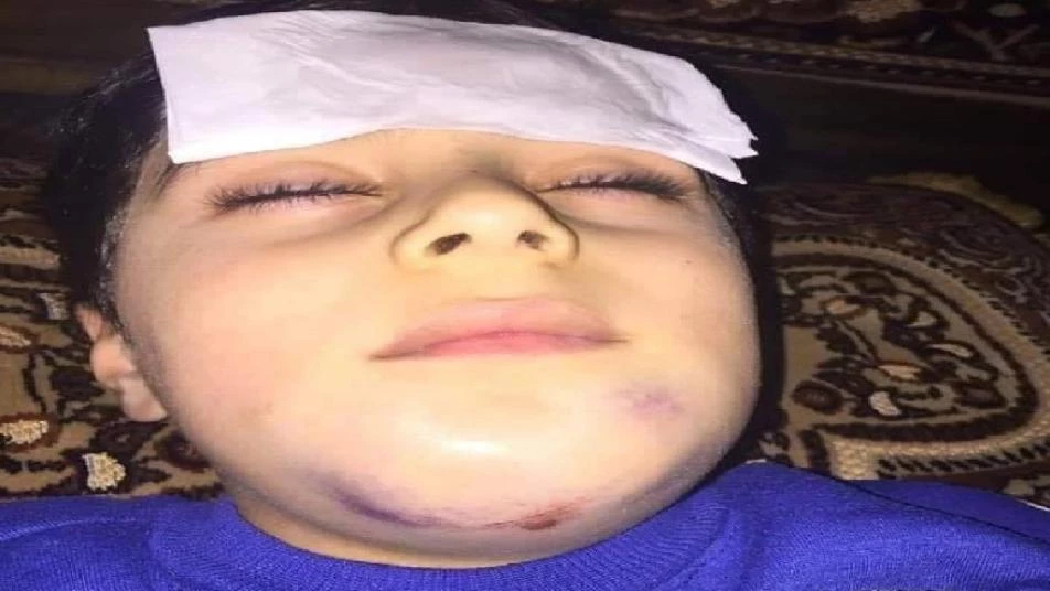 صور صادمة.. معلمة تضرب طفلاً مصاباً في إحدى مدارس النظام بحلب