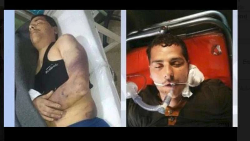 بعد وفاة أحد الكوادر الطبية تحت التعذيب.. مشافي حلب تُضرِب عن العمل