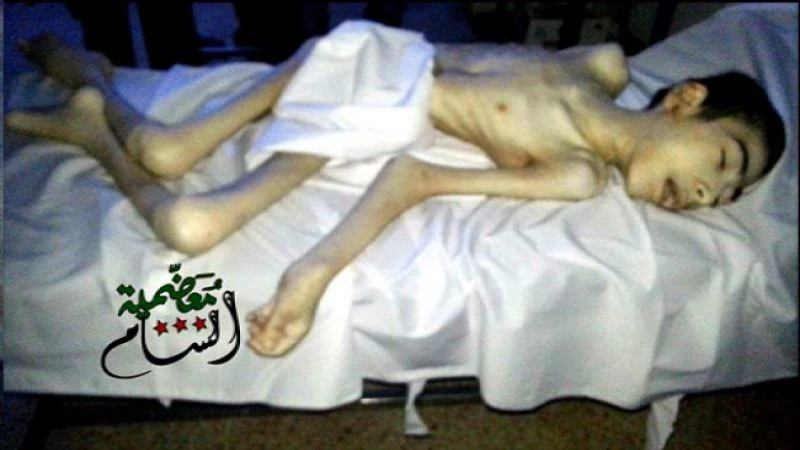 شهداء الجوع: معضمية الشام تعلن وفاة طفلين نتيجة الحصار