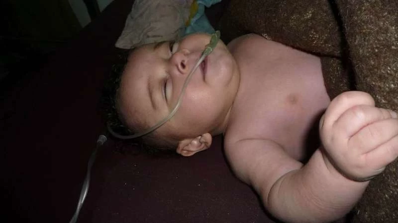 غازات نظام الأسد السامة تخنق أطفال الغوطة  (صور +فيديو)