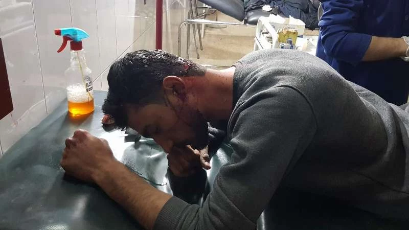 إصابة فريق تلفزيون أورينت جراء القصف على الغوطة الشرقية (صور)