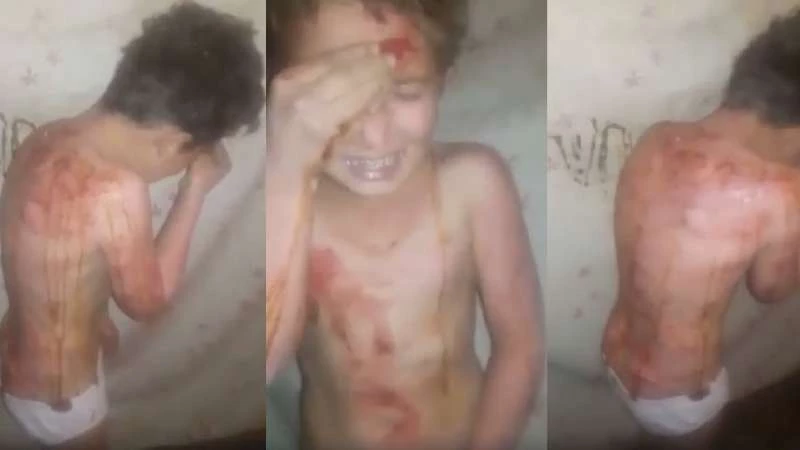 فصائل درعا تحرر طفلاً من عصابة وثقت تعذيبه بالفيديو (فيديو + صور)