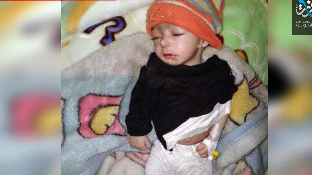 وفاة طفلة رضيعة بسبب نقص الرعاية في مخيم الركبان