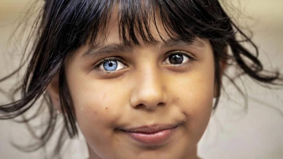 عينان مميّزتان لطفلة سورية تشعل مواقع التواصل في تركيا