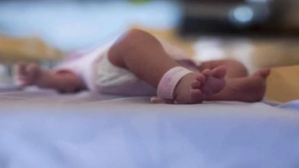 ولادة طفل مصاب بحالة تشوه نادرة جداً في منبج (صور)