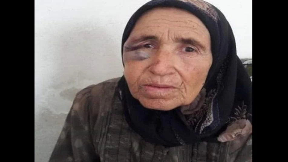  وفاة عجوز بعد تعرضها للضرب من قبل مسلحين في عفرين