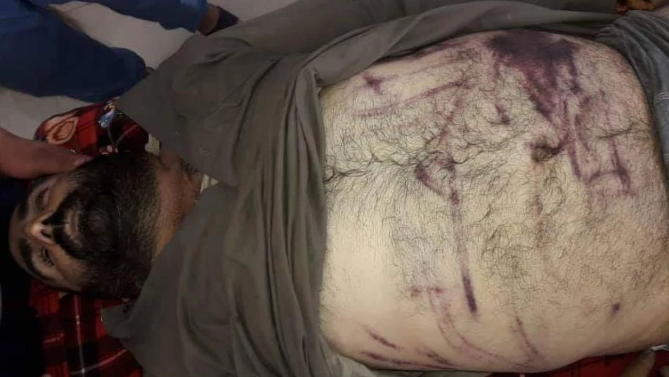 حالات قتل جديدة تحت التعذيب  في سجون "قسد" شرق دير الزور (صور)