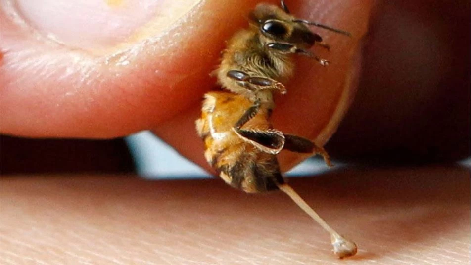 "سم نحل العسل".. علاج لإنقاذ النساء من مرض قاتل