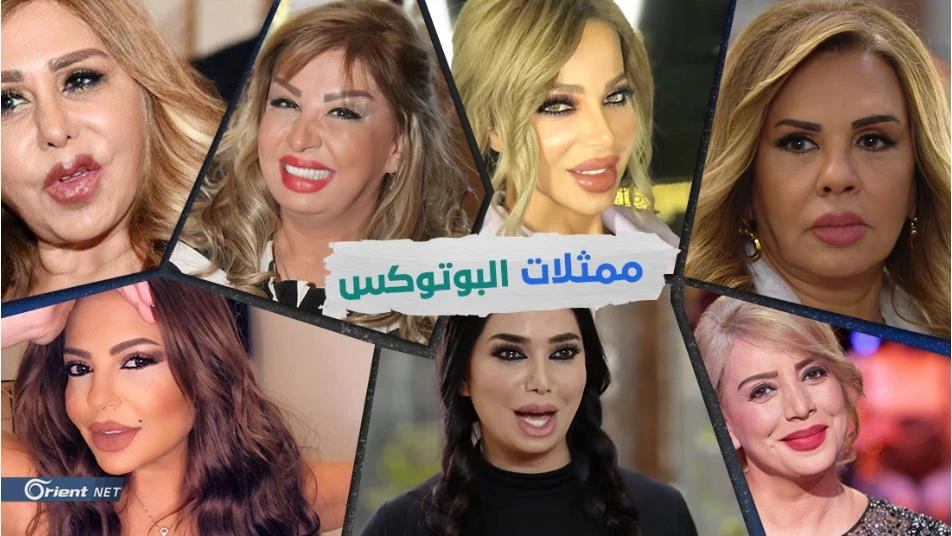 كورونا الدراما السورية 2020: "دراما الفيلر".. وممثلات البوتوكس والشد والتكبير