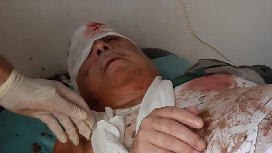 إصابة معراج أورال بجروح بليغة في اللاذقية وسرية "أبو عمارة" تتبنى