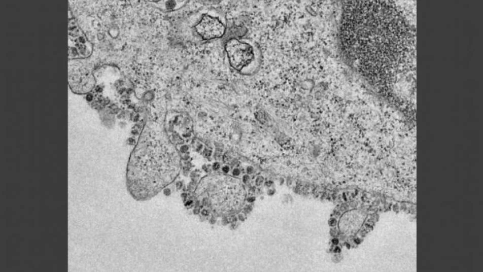 الصورة الأولى لتكاثر خلايا فيروس "كورونا" القاتل