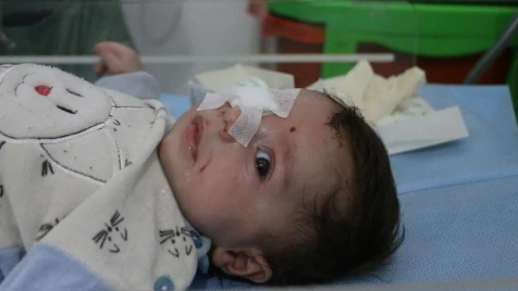 Two-month-old Syrian infant loses eye in Assad-Russian attack in Idlib