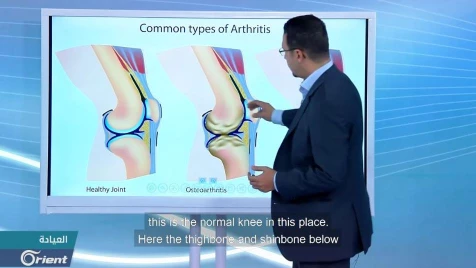 The Clinic explains knee pain