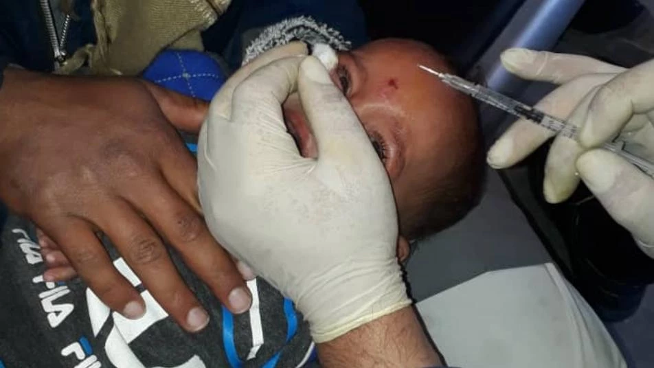 Skin disease ravages Syrian children in Deir ez-Zoor
