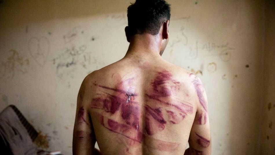 Assad regime uses sexual violence to humiliate detainees